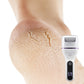 ✨Portabil Electric Foot Callus Remover - îndepărtarea rapidă și eficientă a pielii moarte🦶